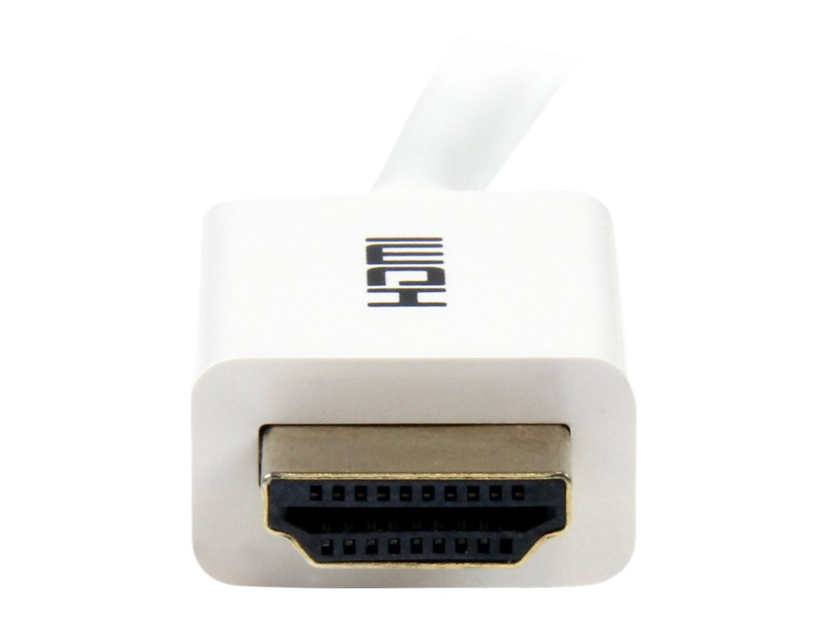 StarTech.com 5m High-Speed-HDMI-Kabel - Ultra